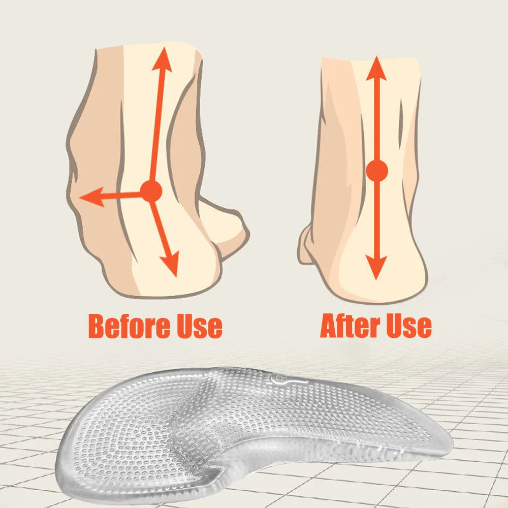 Orthopedische Inlegzolen van Siliconengel